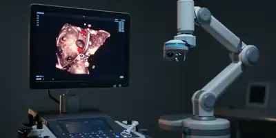 Inteligência Artificial Revoluciona Diagnóstico de Doenças Hepáticas com Detecção Precoce e Precisa